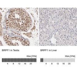 BRPF1 Antibody, Novus Biologicals 25 &mu;L | Buy Online | Novus Biologicals | Fisher Scientific